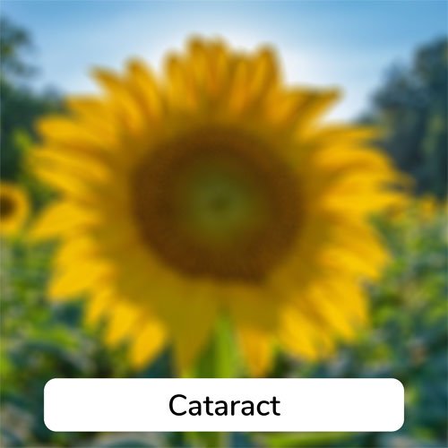 Simulation of what vision with a cataract looks like